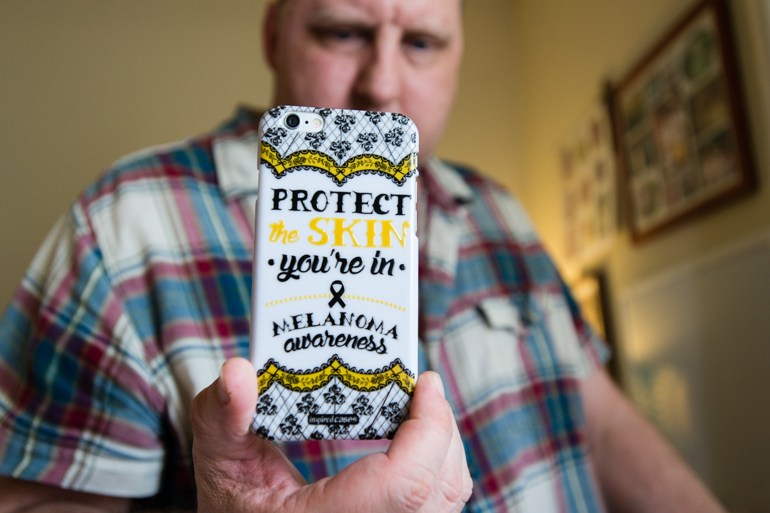 Fairchild holds a cell phone cover he found online. He became an advocate for melanoma awareness since being diagnosed with the cancer. (Heidi de Marco/KHN)