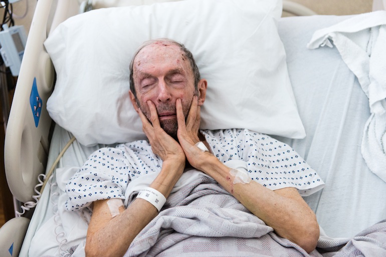 Elderly Hospital Patients Arrive Sick, Often Leave Disabled | Kaiser ...