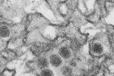 A transmission electron micrograph of Zika virus, which is a member of the family Flaviviridae, is shown. (Cynthia Goldsmith/CDC)