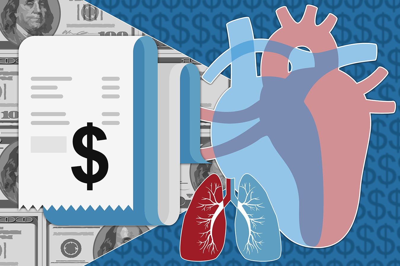No Cash, No Heart. Transplant Centers Require Proof Of Payment. | Kaiser  Health News