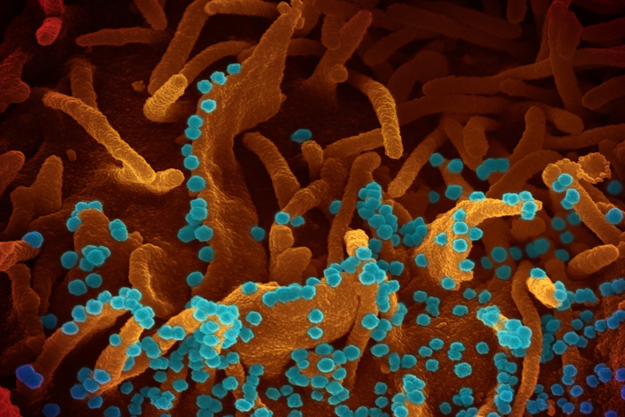 Científica genera imágenes del coronavirus para que todos vean al “enemigo invisible” | Kaiser Health News