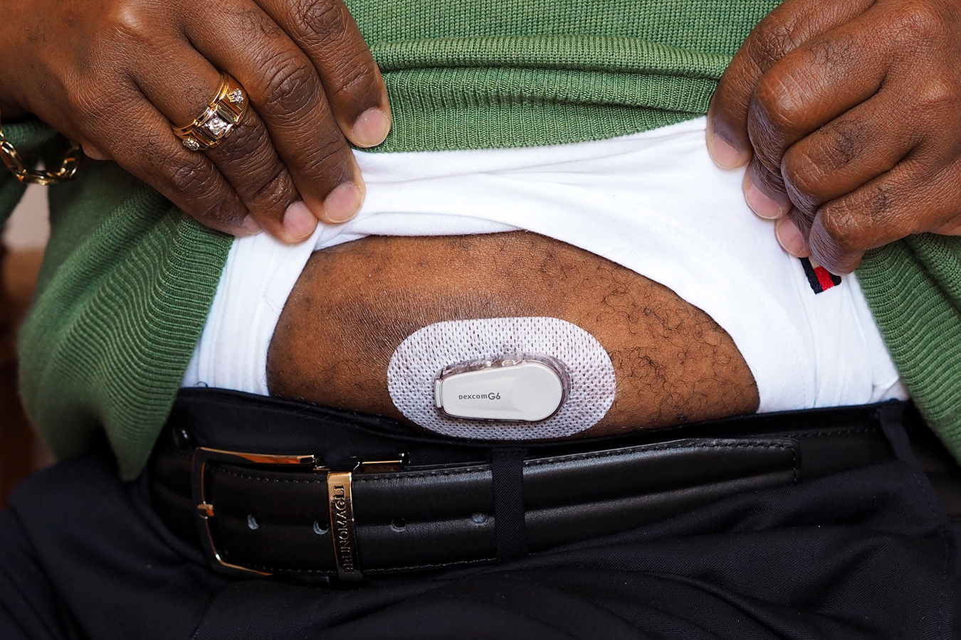 ‘Painless’ Glucose Monitors Pushed Despite Little Evidence They Help Most Diabetes Patients