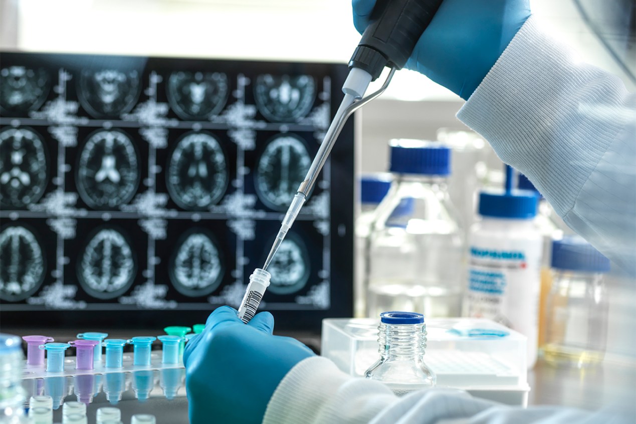 A gloved hand uses a pipette to divide liquid into test tubes. A screen shows a series of brain scans behind the lab equipment.