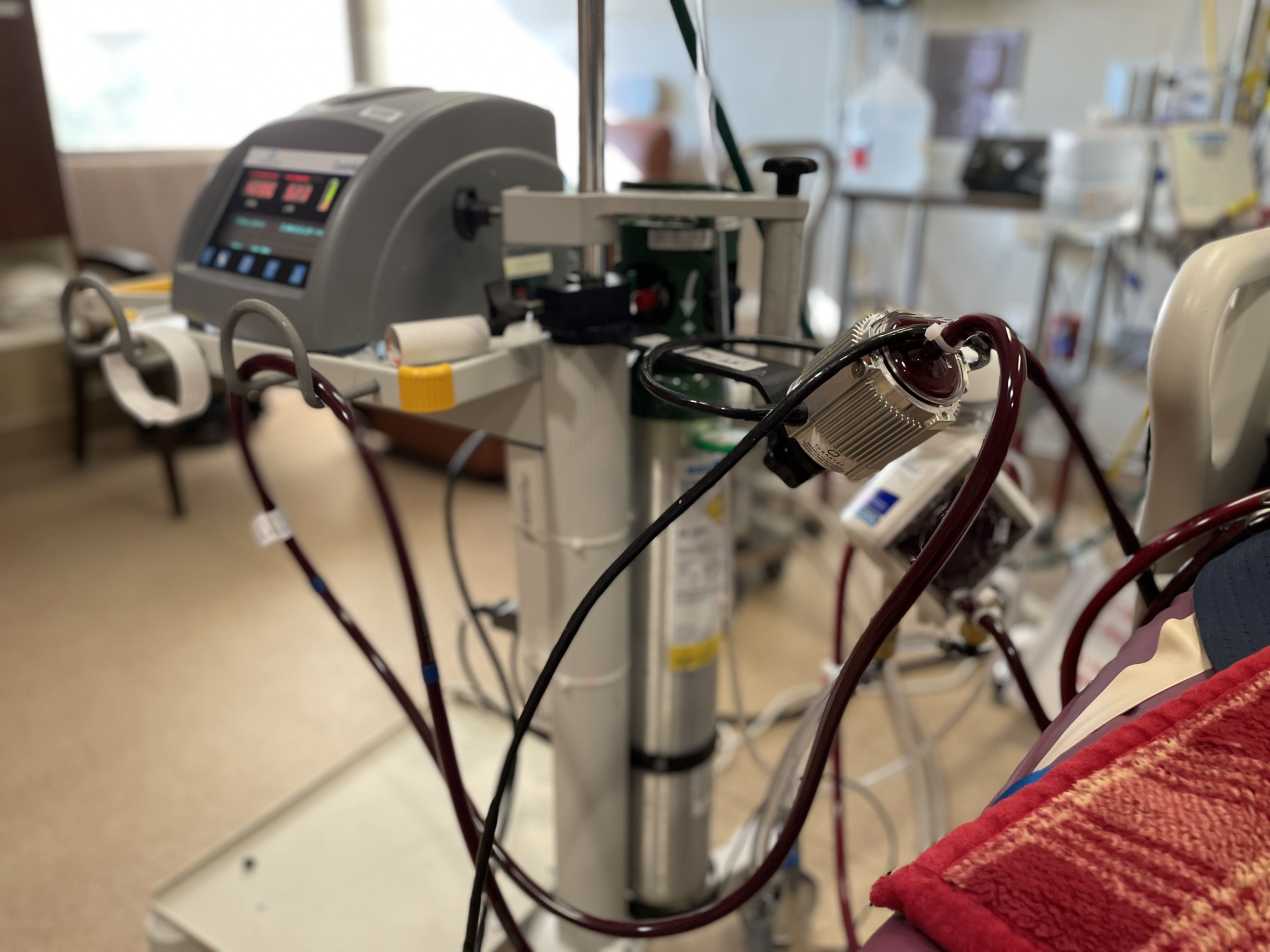 A closeup photo shows red tubes looping around an ECMO machine in a hospital room.