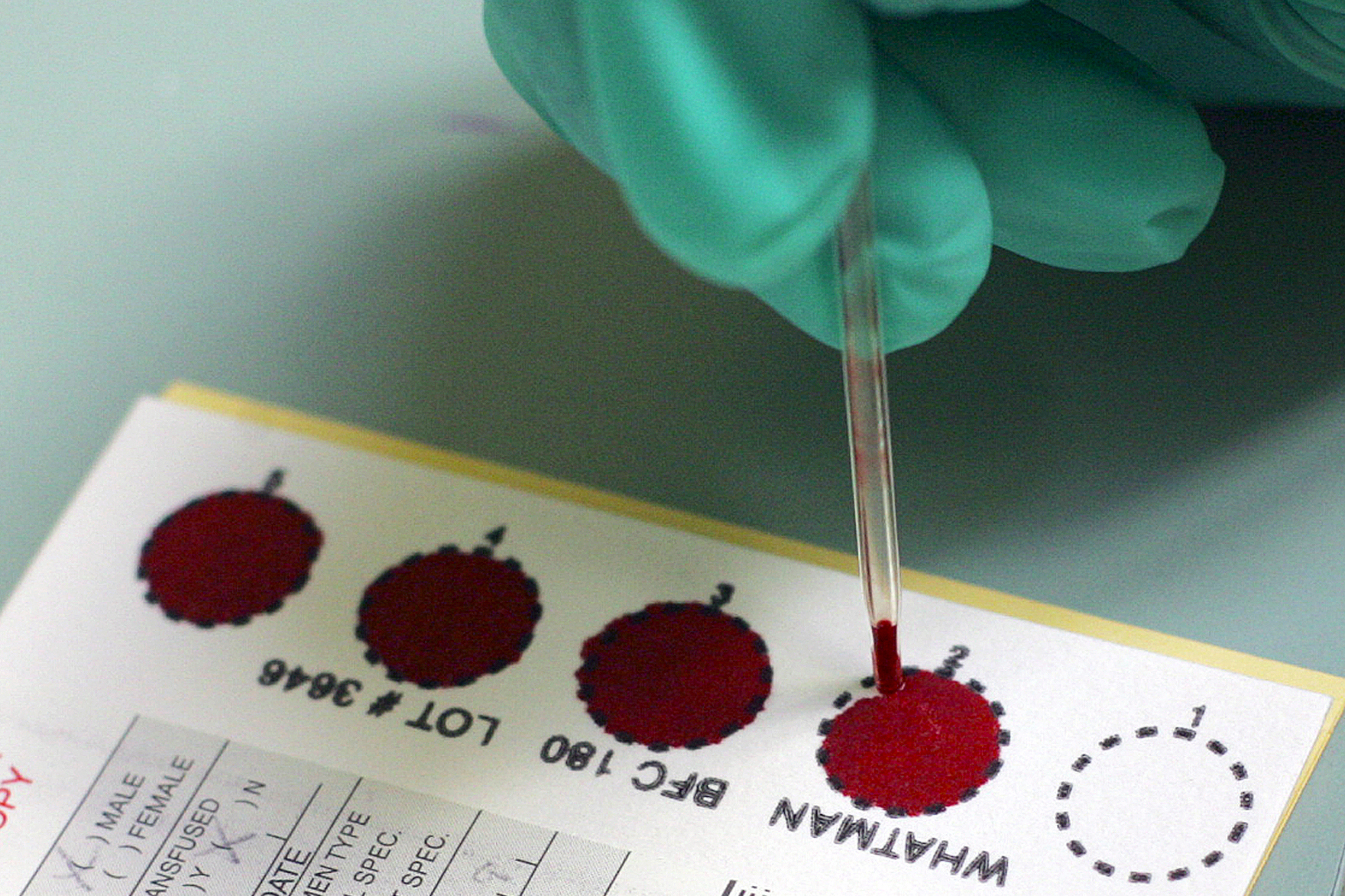 A los recién nacidos se les extrae sangre para analizarla, ¿deben los estados conservar esas muestras?