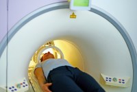 A photo shows a woman receiving an MRI scan to check for brain tumors.