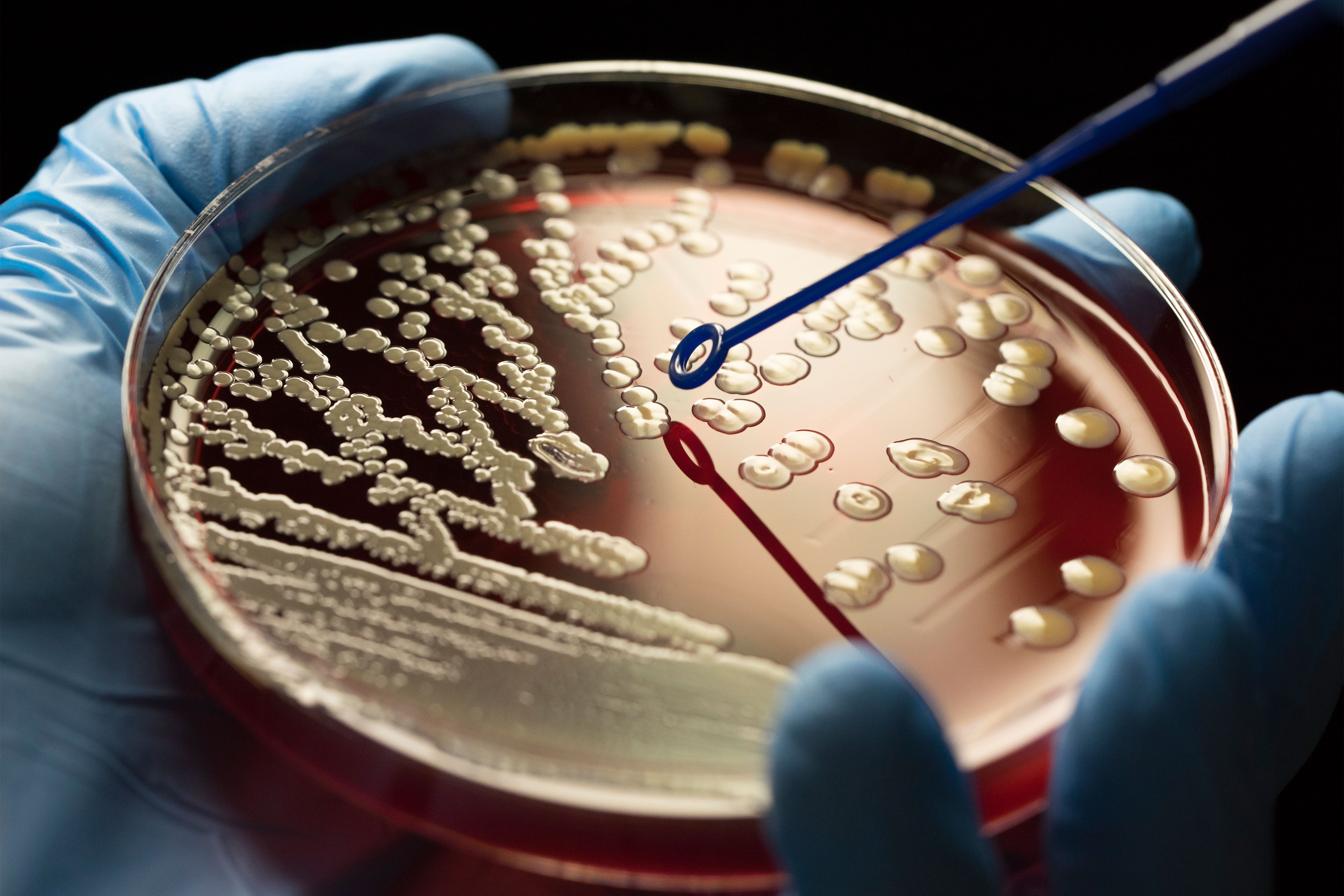 Is Legislation to Safeguard Americans Against Superbugs a Boondoggle or Breakthrough?