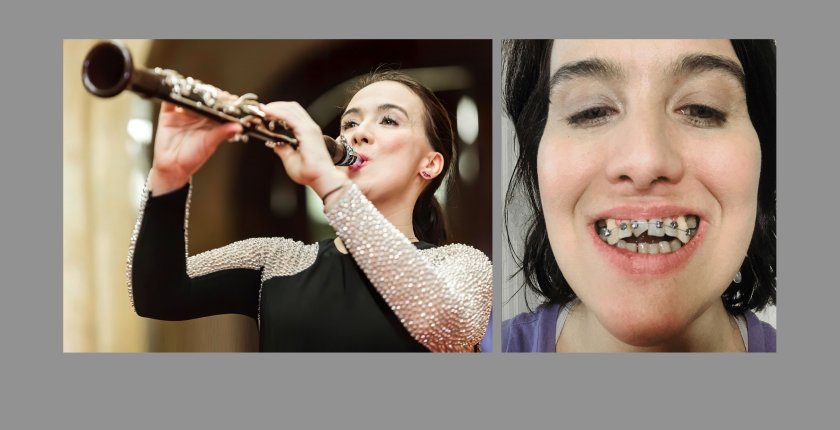 Two photos are shown side by side. The left is of a young woman playing a clarinet at a concert. The right is of the same woman showing her misaligned teeth.